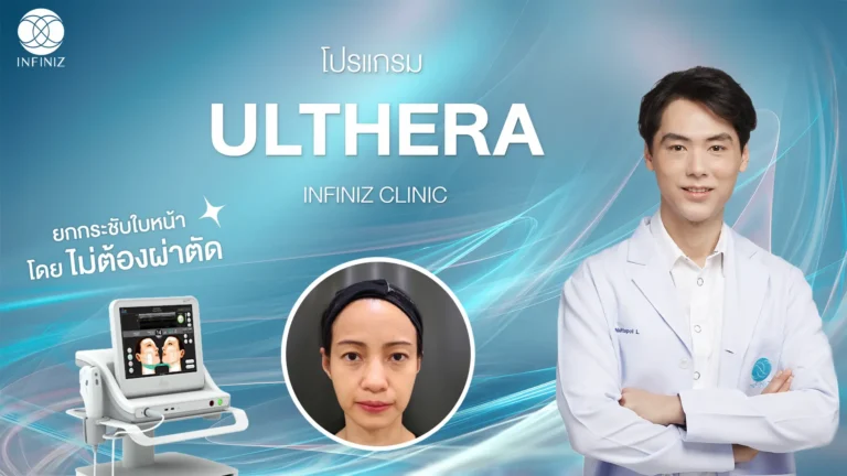 ulthera