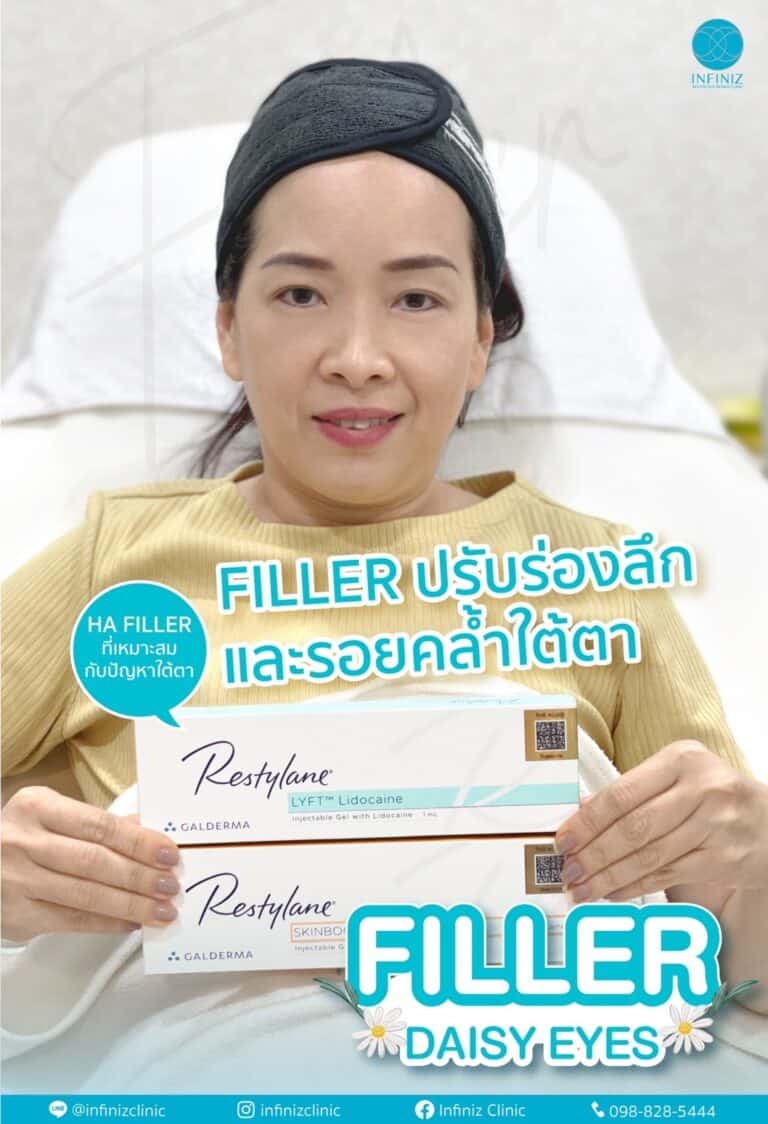 ฟิลเลอร์ Restylane