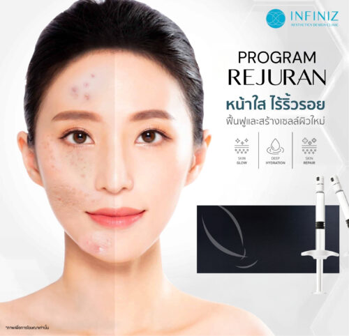 ทำความรู้จัก Rejuran ฉีดผิวคืออะไร ดีไหม และสามารถช่วยในเรื่องอะไรบ้าง 3 Web June 0 04