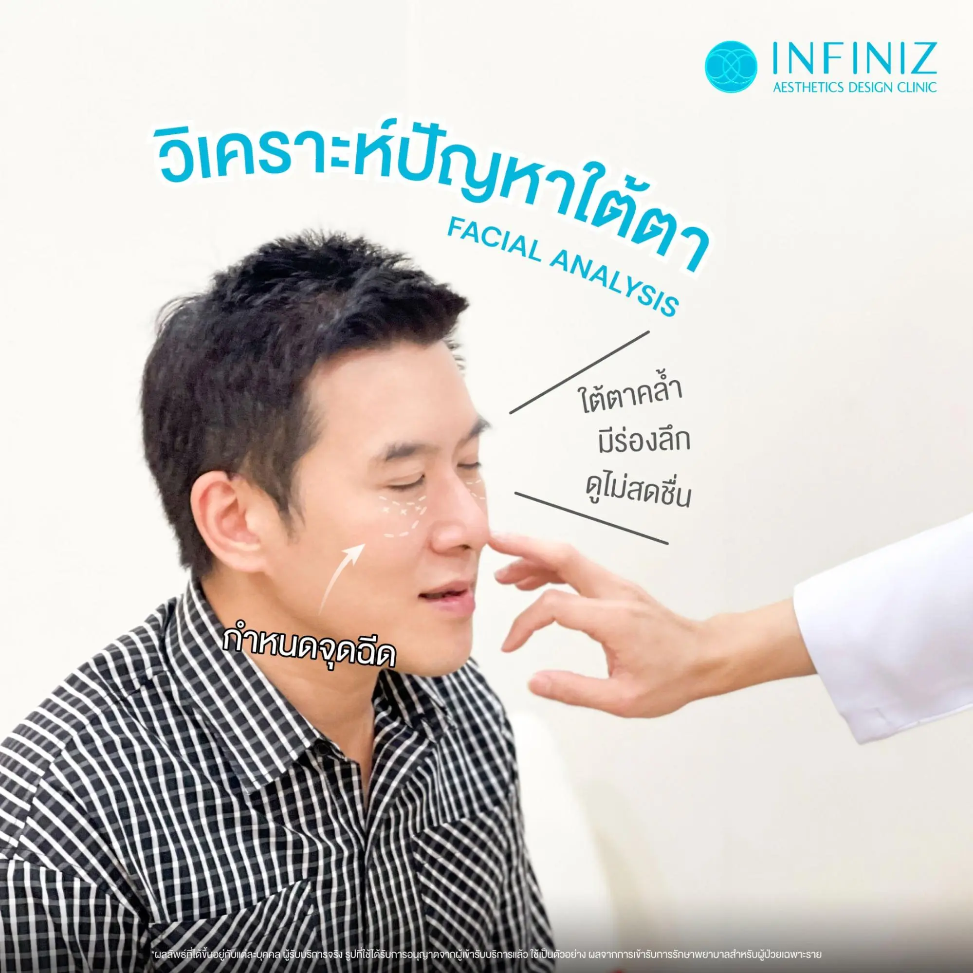 โปรแกรมทำฟิลเลอร์ใต้ตา ราคาพิเศษปี 2026