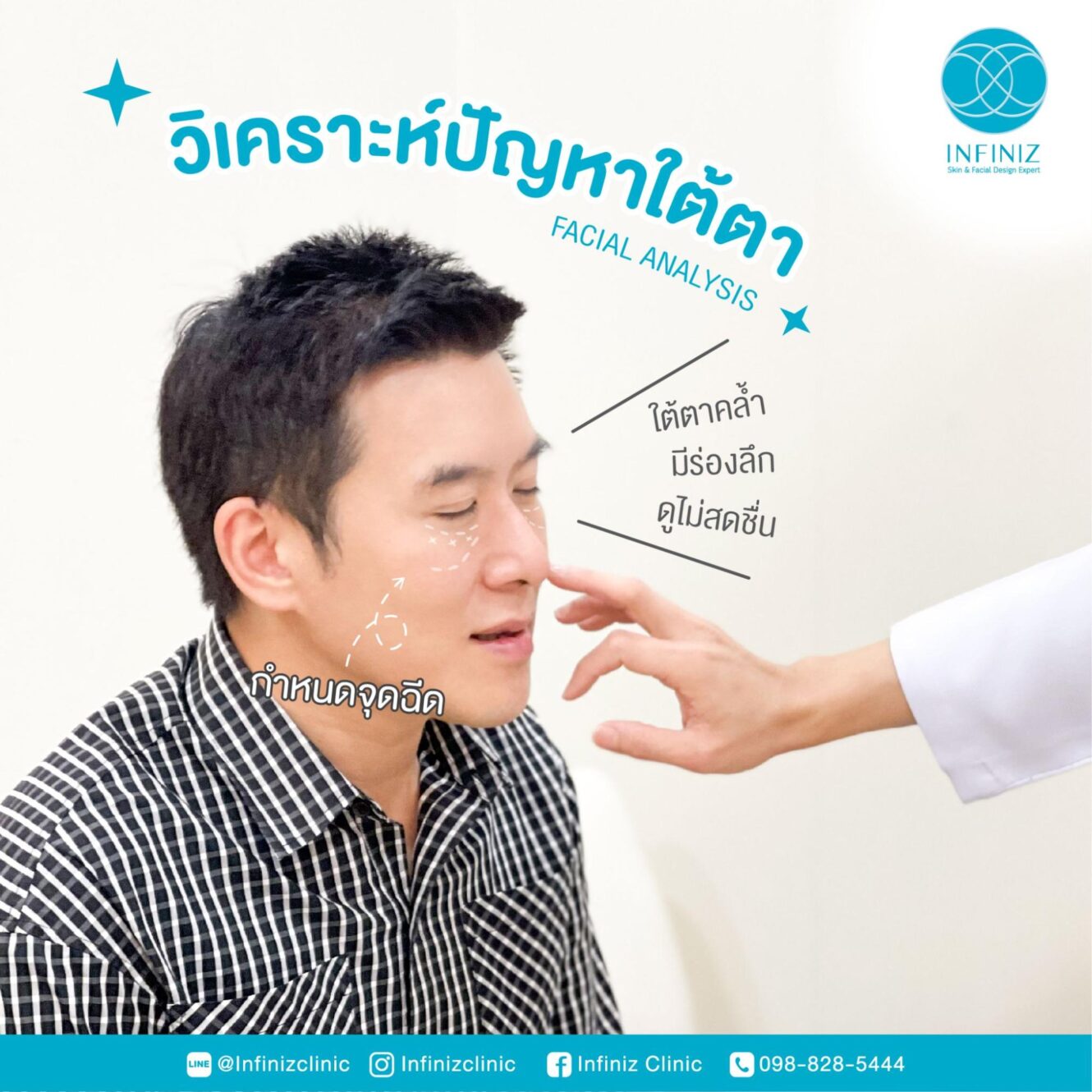 ฟิลเลอร์ใต้ตา