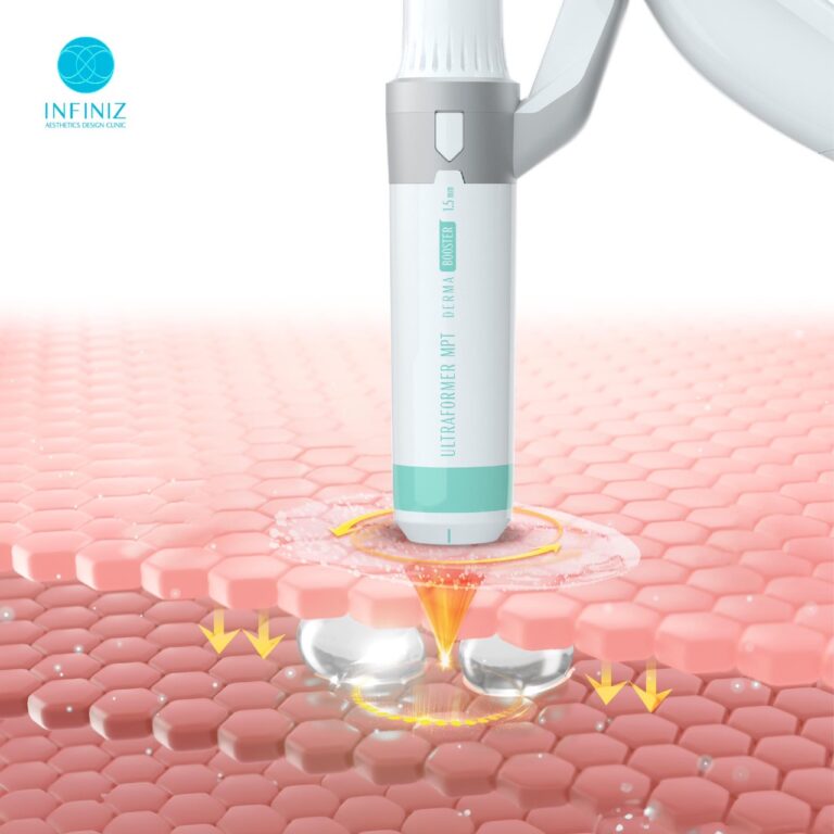 ปรับรูปหน้าให้เรียวสวย ด้วยโปรแกรมUltraformer MPT ที่ Infiniz Clinic 13 S 6553611 0