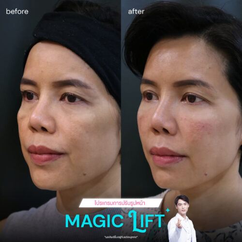 Magic-lift-review2