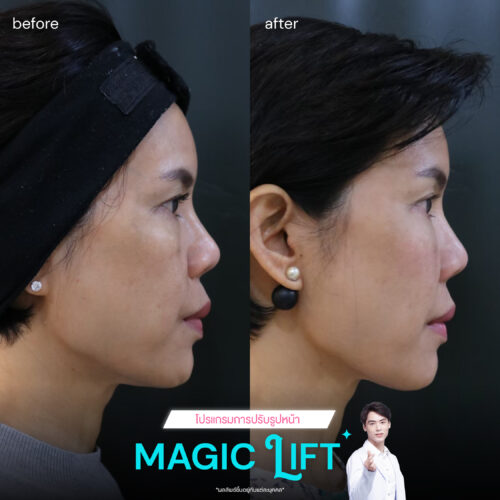 Magic-lift-review1