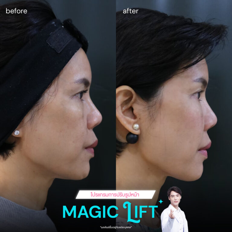 Magic-lift-review1
