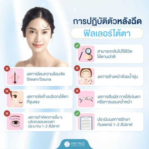 โปรแกรมฉีดฟิลเลอร์ใต้ตา แก้ปัญหาใต้ตาคล้ำ ลดถุงใต้ตา โดยไม่ต้องผ่าตัด 10 ดูแลตนเองหลังฉีดฟิลเลอร์ใต้ตา