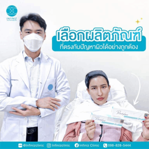 ยี่ห้อฟิลเลอร์