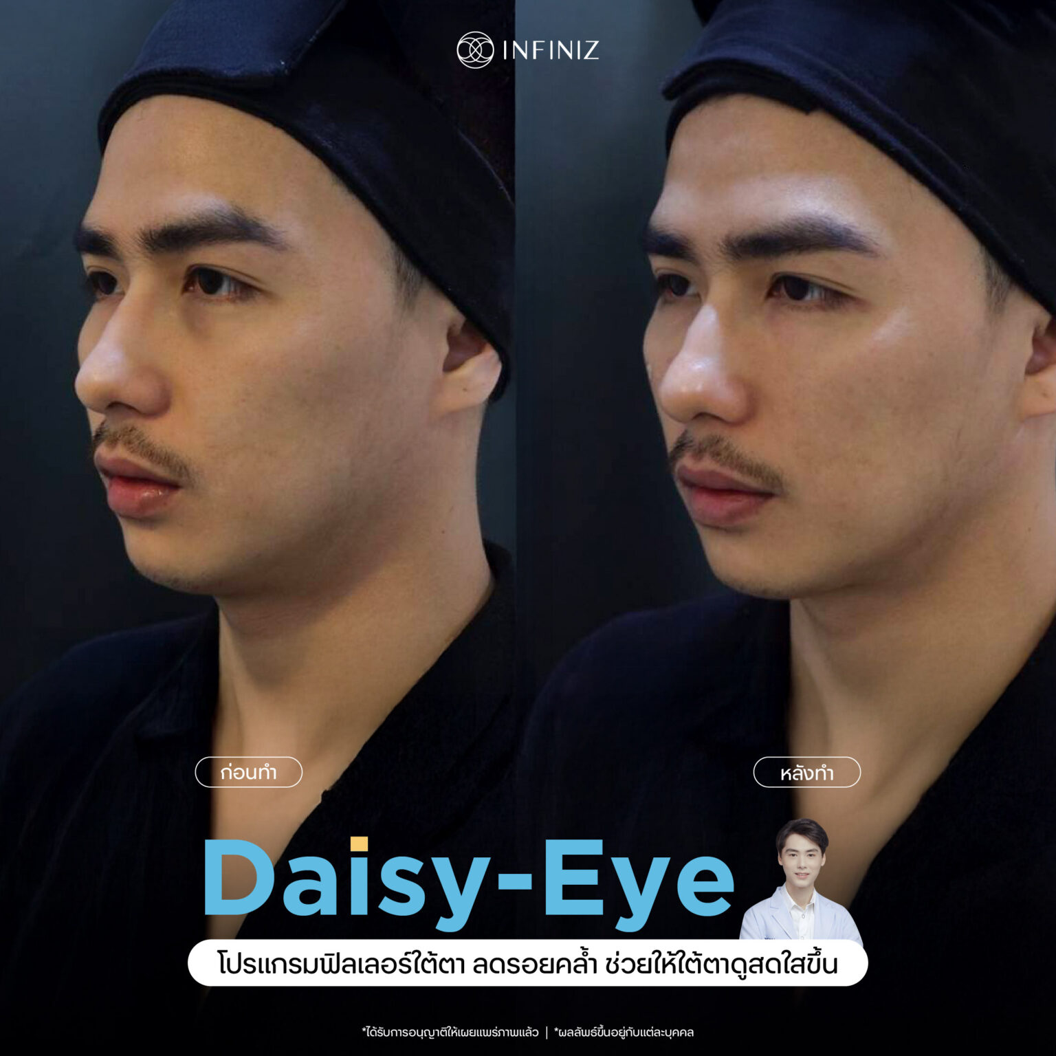 web B&A - eyes-02