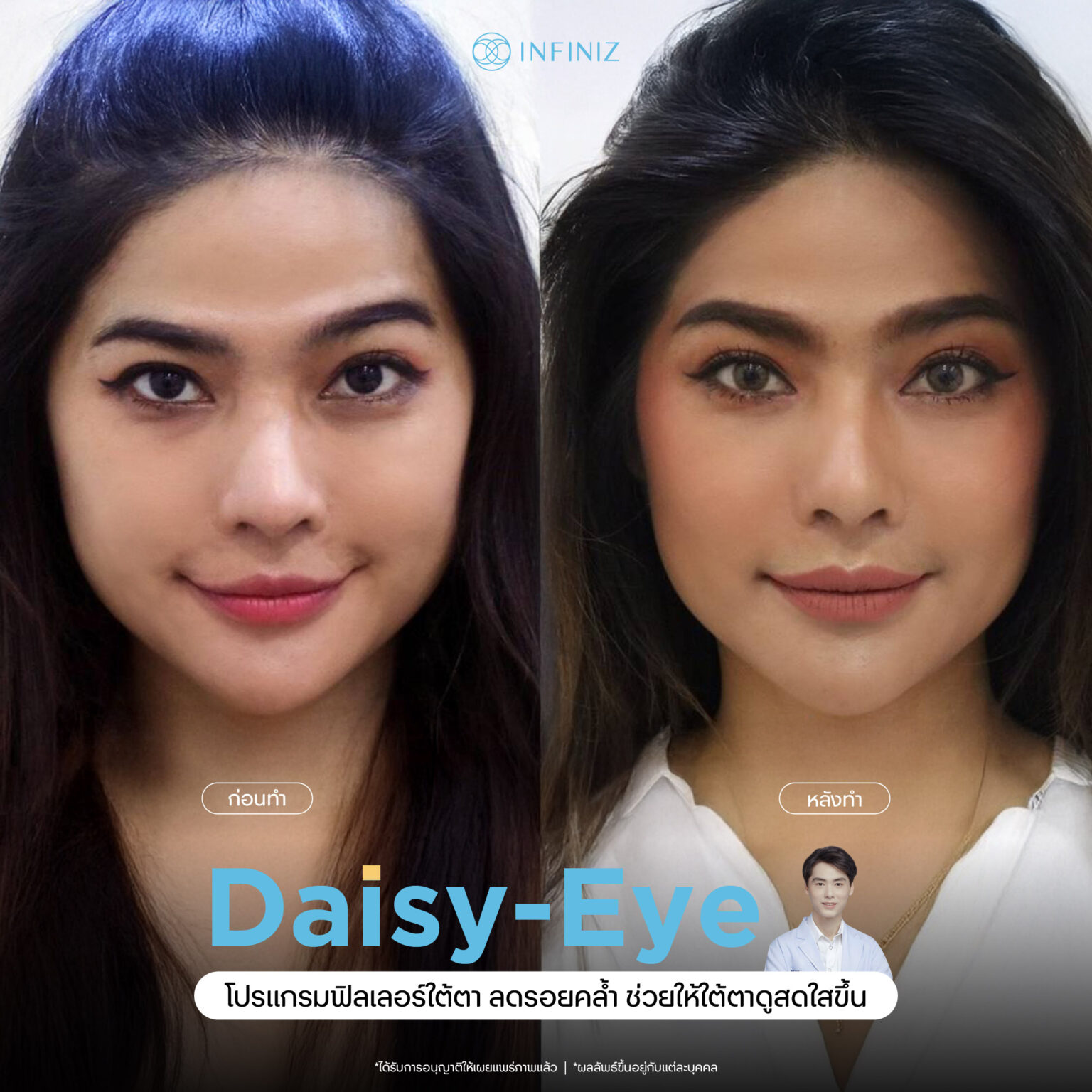 web B&A - eyes-03