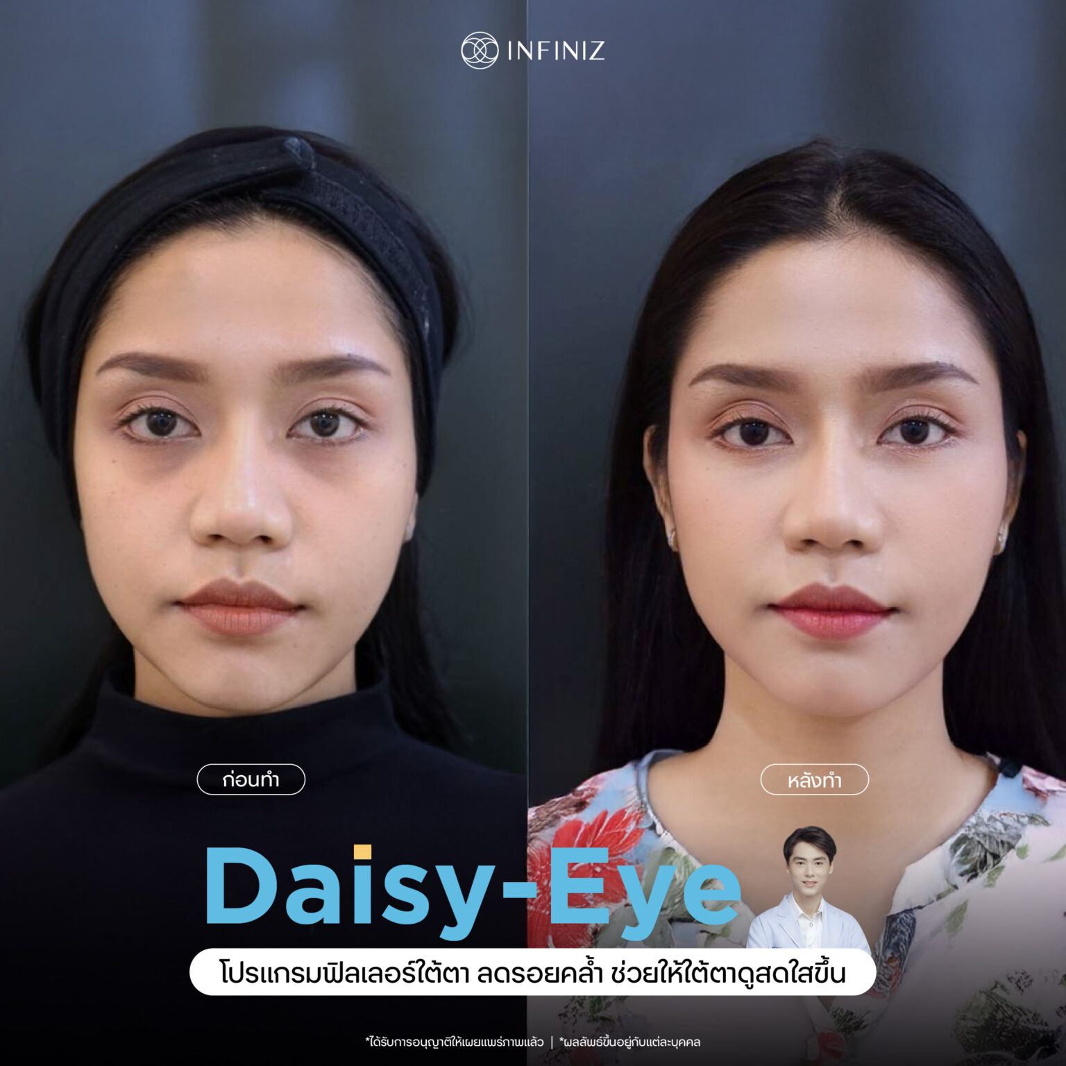 web B&A - eyes-04
