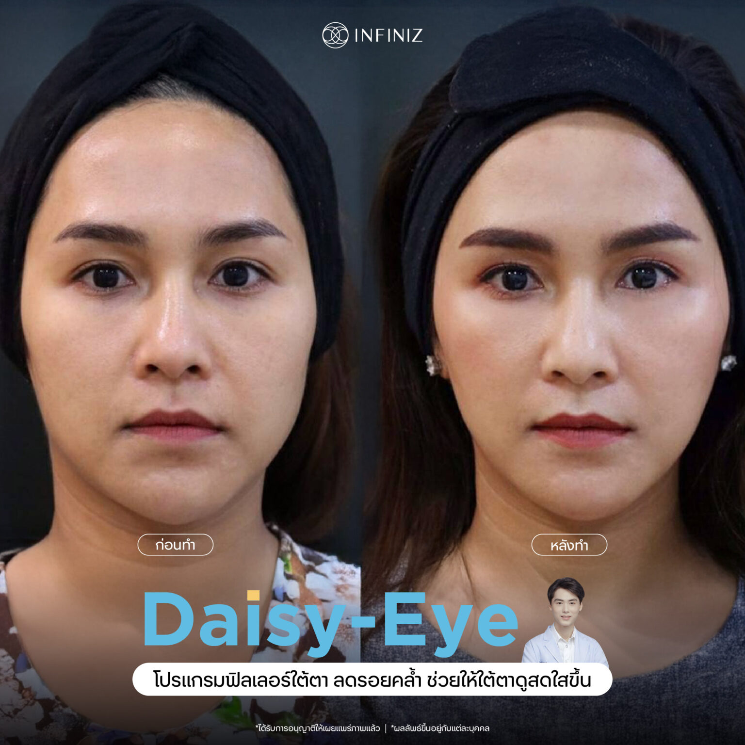 web B&A - eyes-06