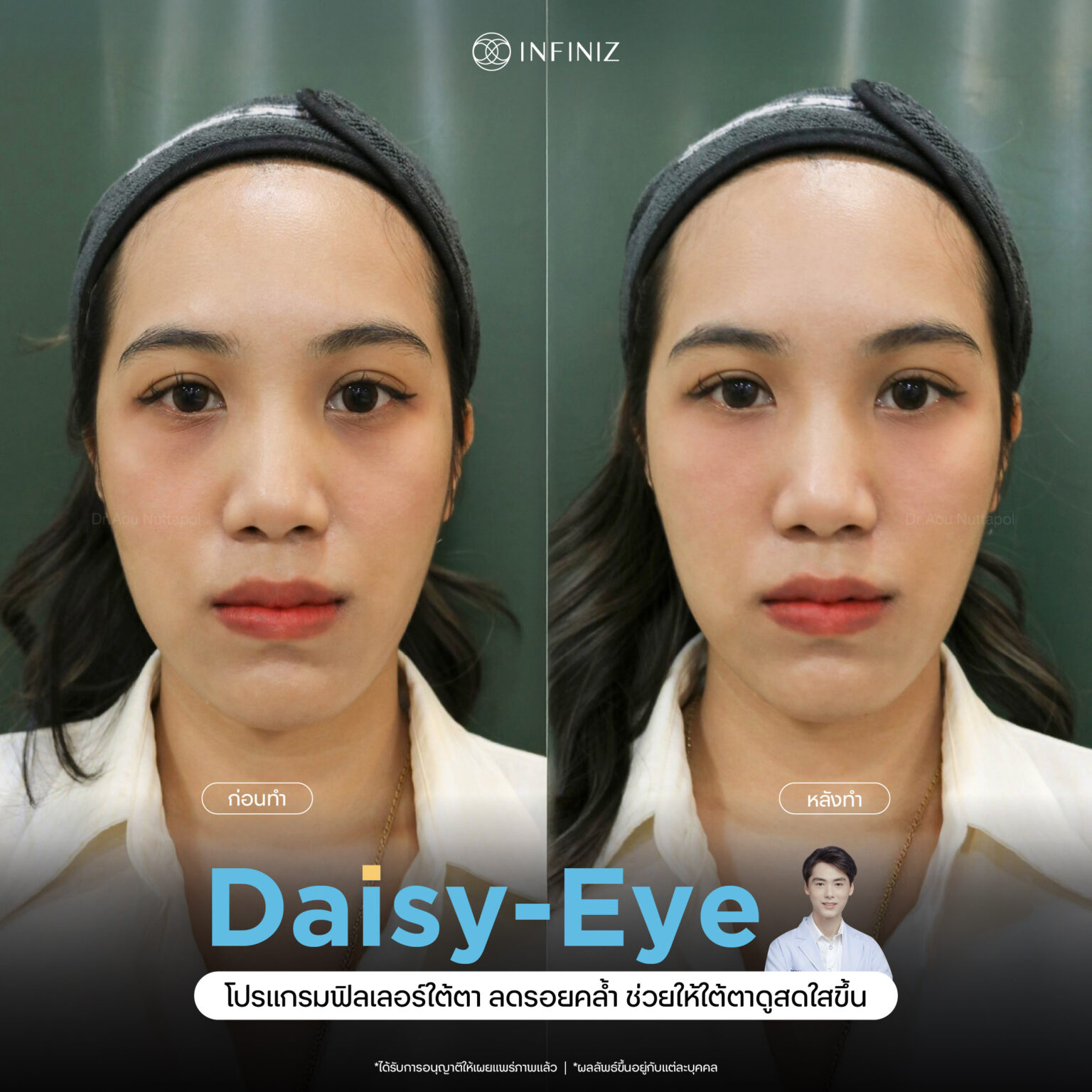 web B&A - eyes-07