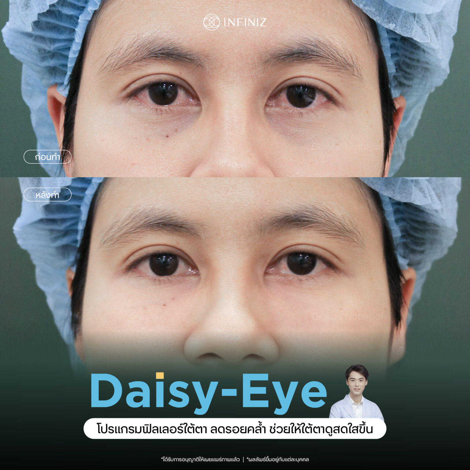 web B&A - eyes-08