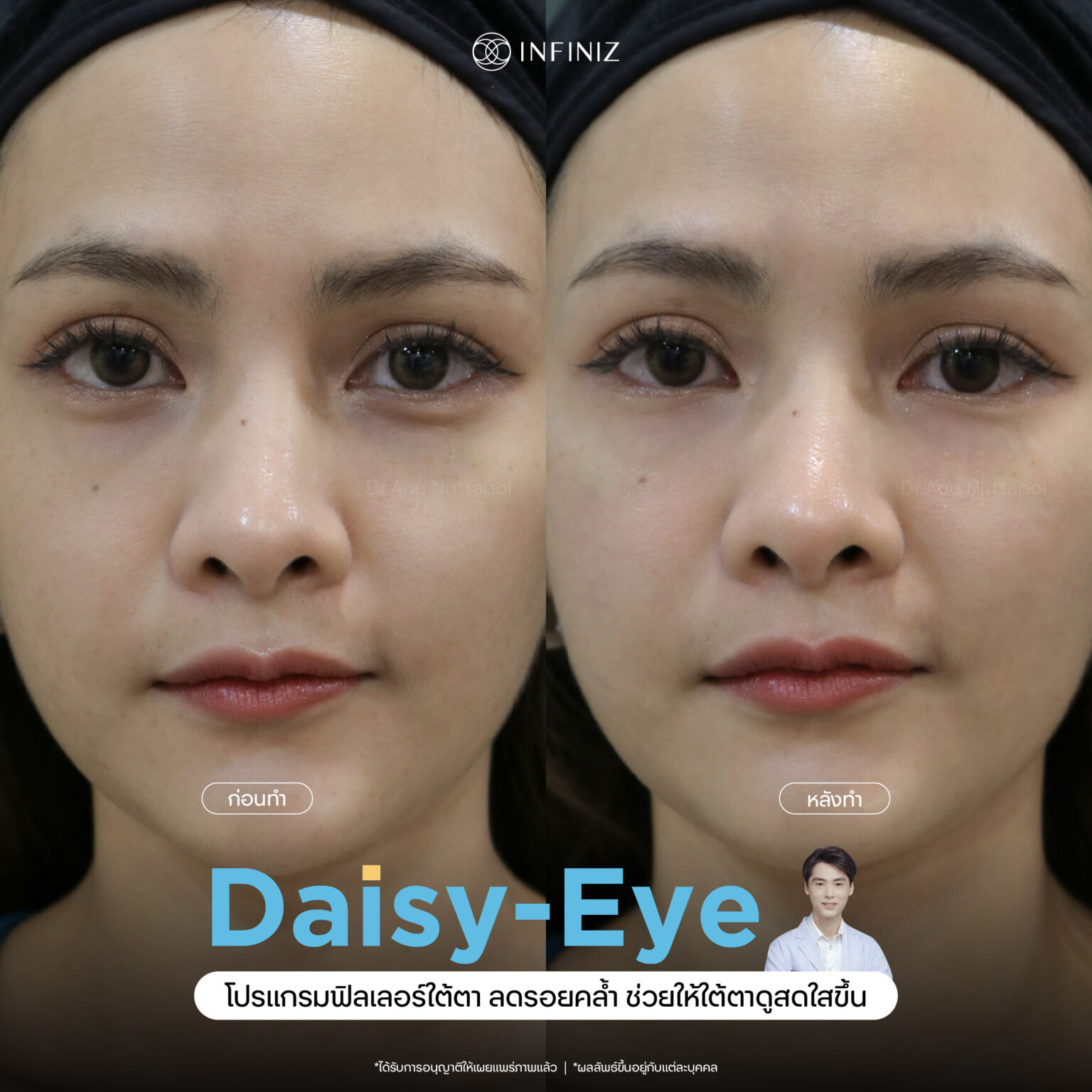 web B&A - eyes-09