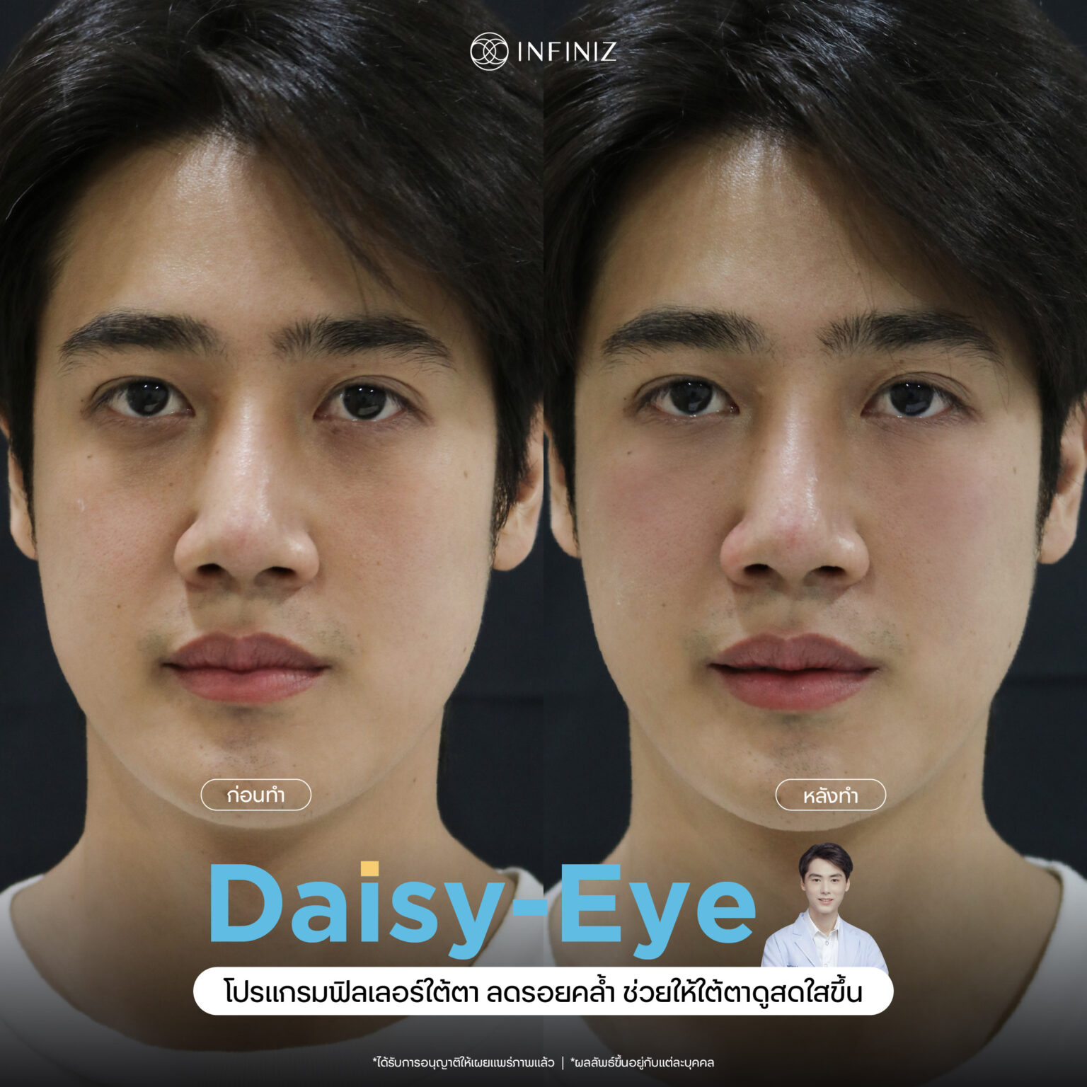 web B&A - eyes-11