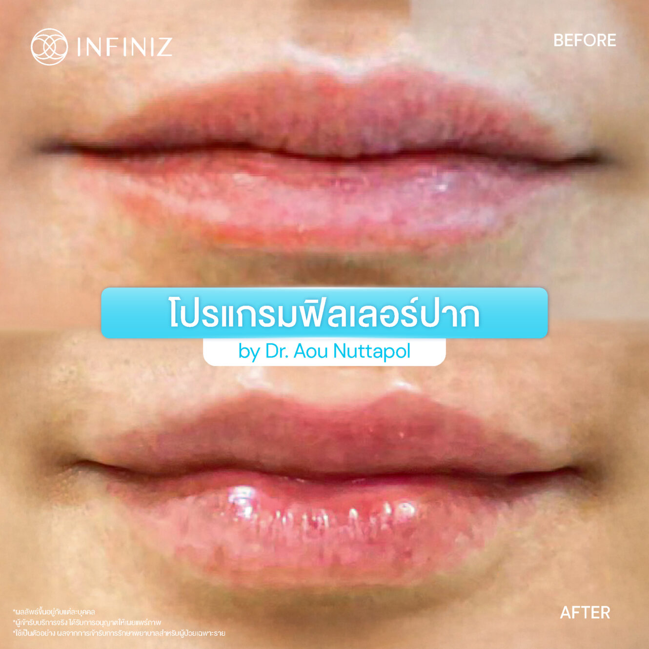 BA Lip Aug 25 09