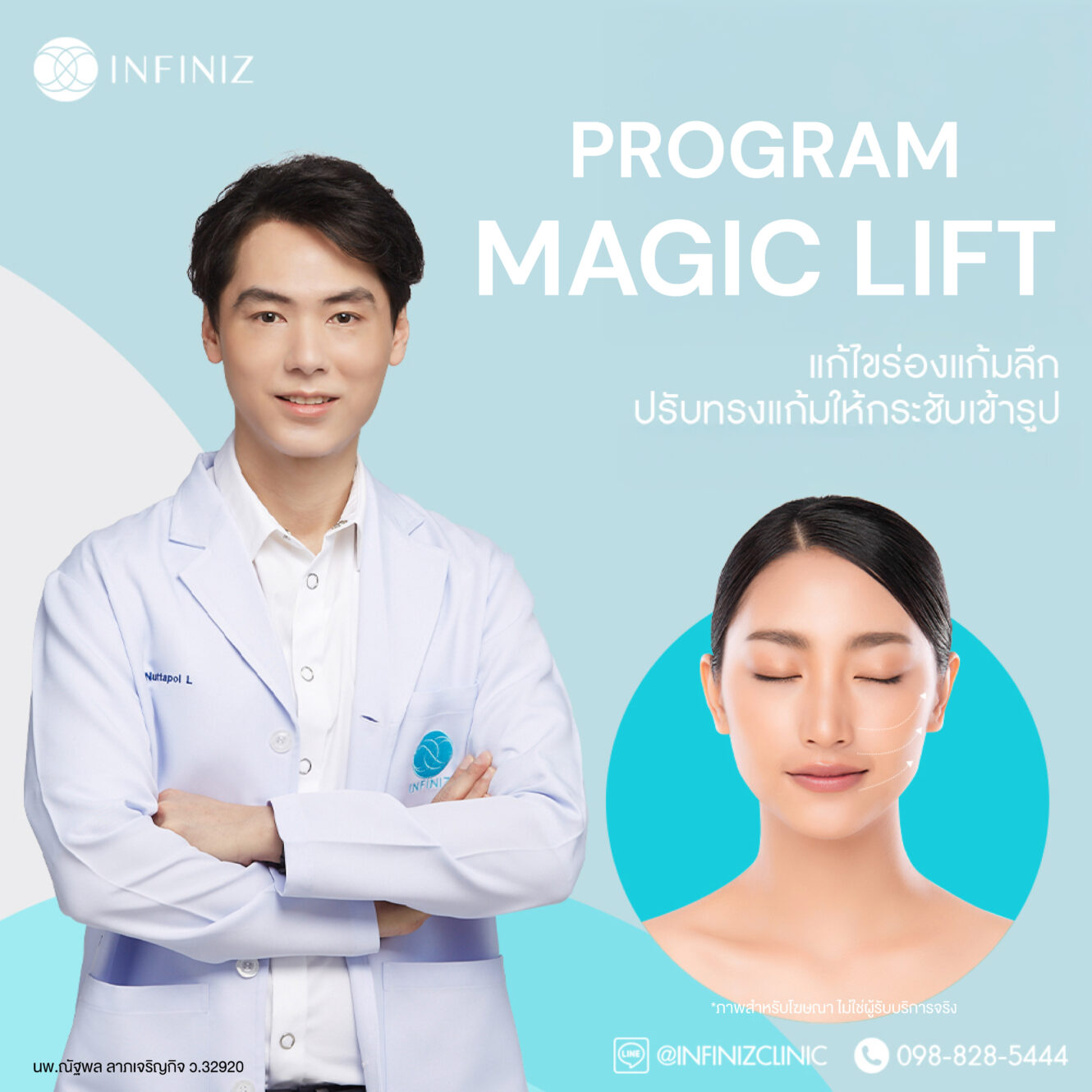 โปรแกรมฟิลเลอร์ร่องแก้ม และ การยกกระชับแบบ Magic Lift 1 edit AW Web Old 06