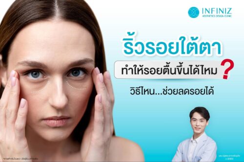 ริ้วรอยใต้ตา