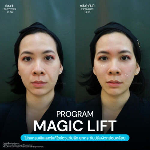 Magic Lift 19