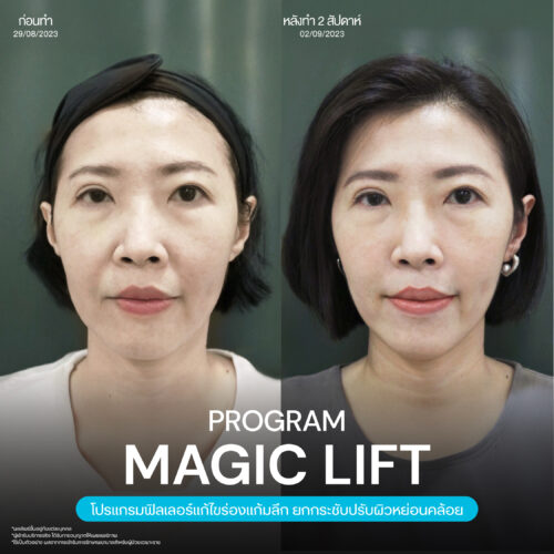 Magic Lift 23