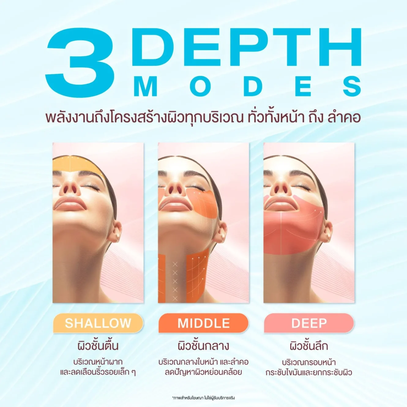 โปรแกรม XERF หัตถการยกกระชับล่าสุด เหมาะกับใคร ดีกว่าเครื่องอื่นยังไง? 3 XERF ช่วยอะไร