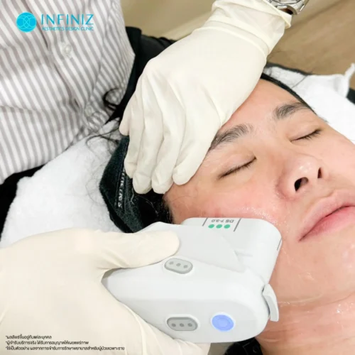 Ulthera ที่ไหนดี