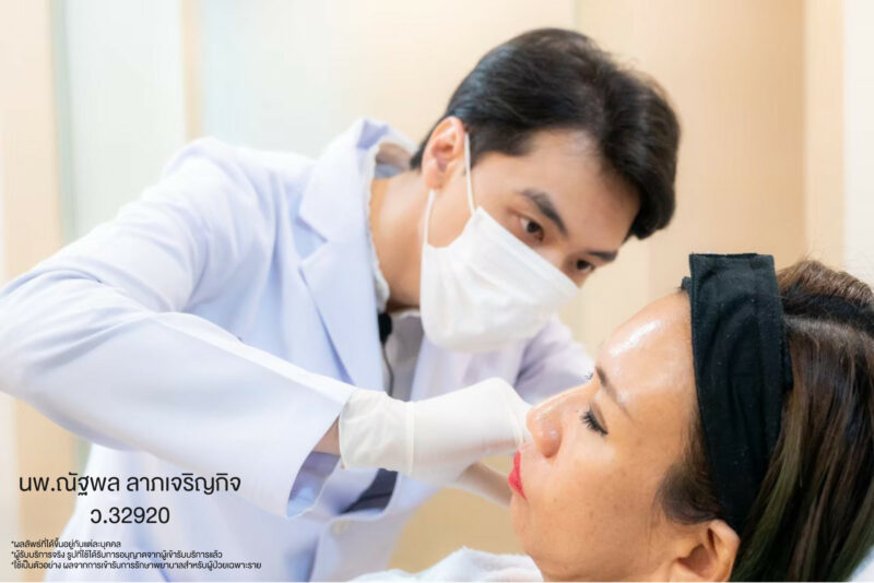 โปรแกรม Restylane Vital Light ลดริ้วรอยและร่องลึกใต้ตา 1 filler for sunken cheeks