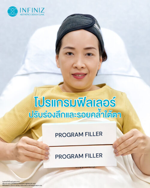 fillrt effect eye 12