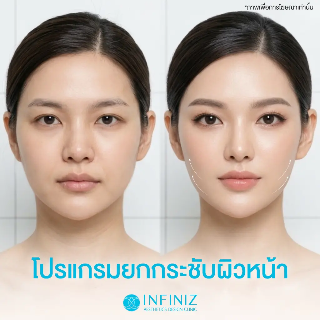 รีวิวยกกระชับหน้า