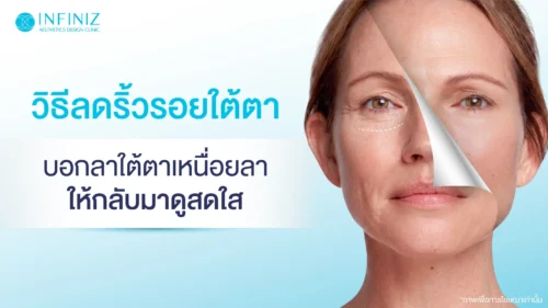 ริ้วรอยใต้ตา