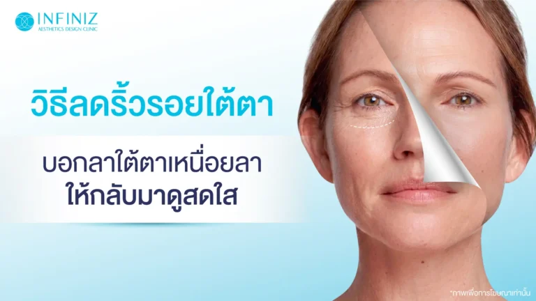 ริ้วรอยใต้ตา